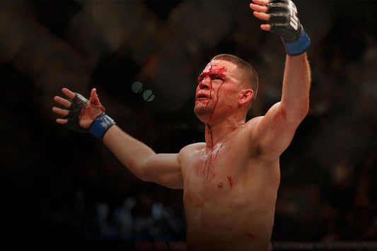 Nate Diaz Asks UFC for Release